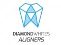 Diamond Whites Aligners